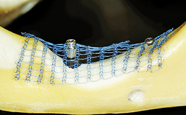 Новая статья о Титановом Шёлке в журнале «Проблемы стоматологии».